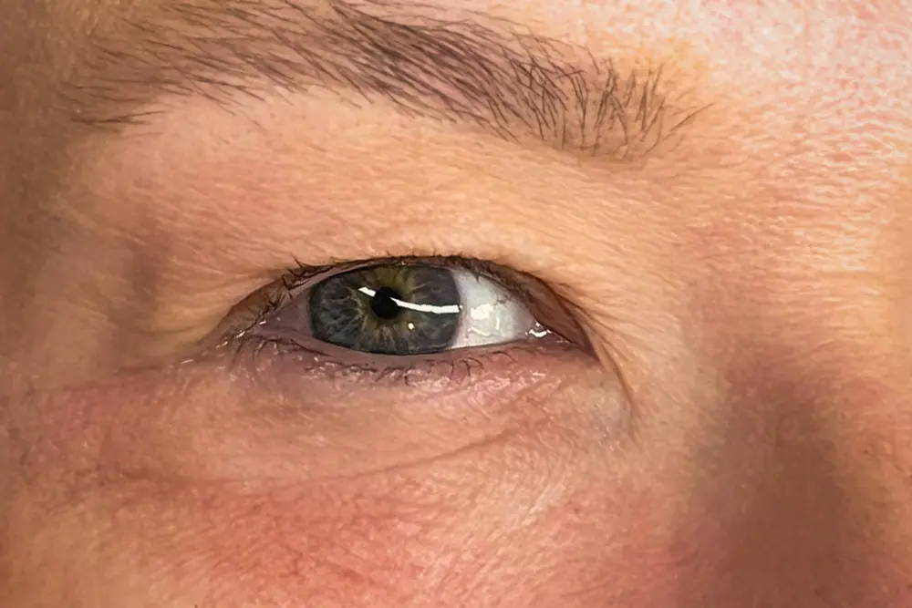 Wimpern vorher