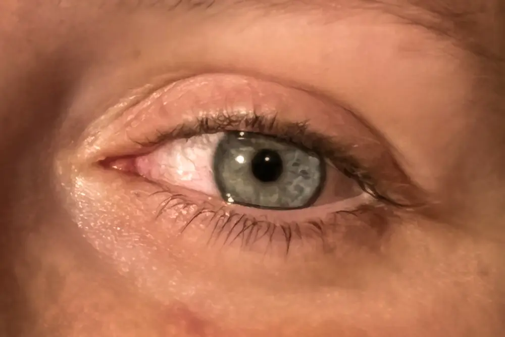 Wimpern vorher
